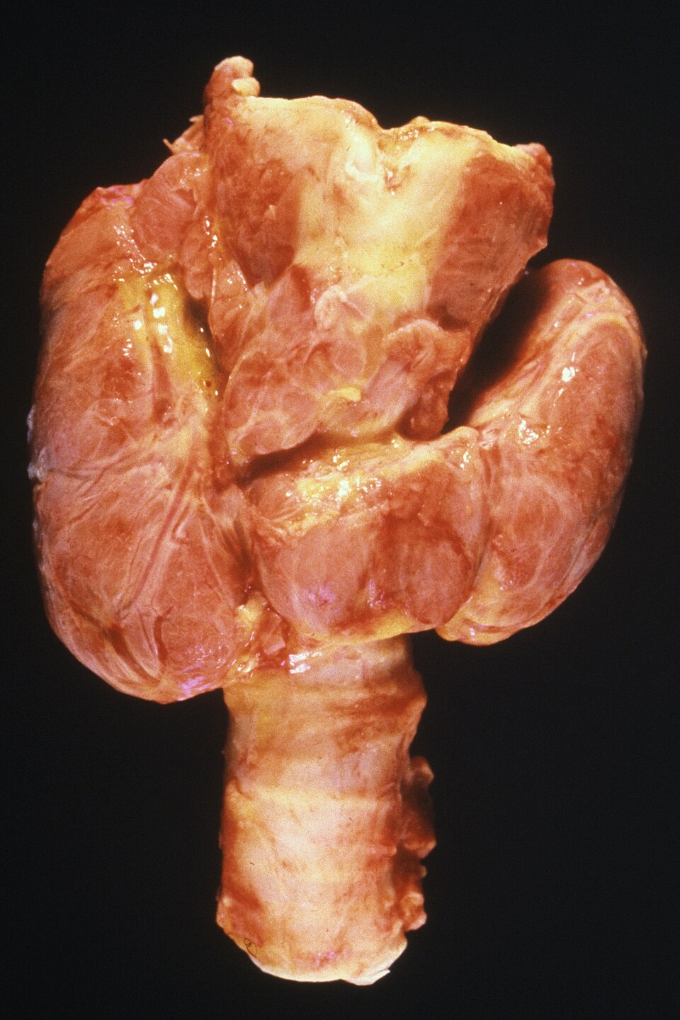 Histología tiroidea
